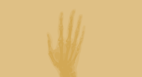 Hand &amp; Wrist Image 1