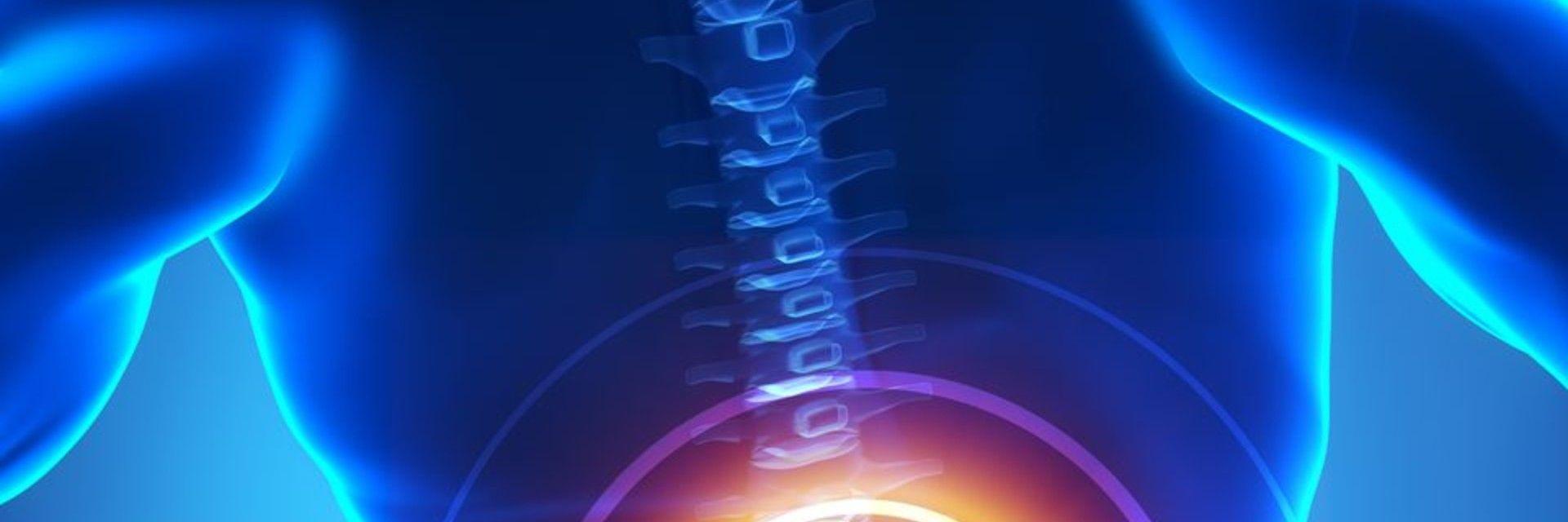 Sciatica Treatment  Florida Orthopaedic Institute