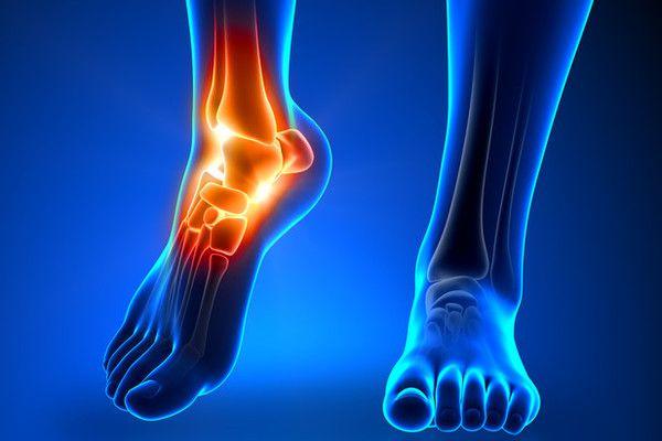 achilles pain while walking