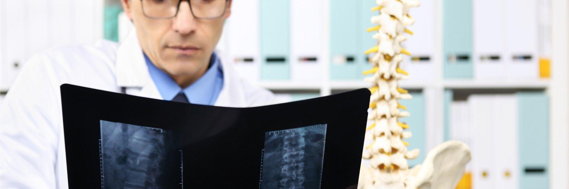 Is Spinal Reconstructive Surgery for Deformities the Right Treatment for Your Condition?