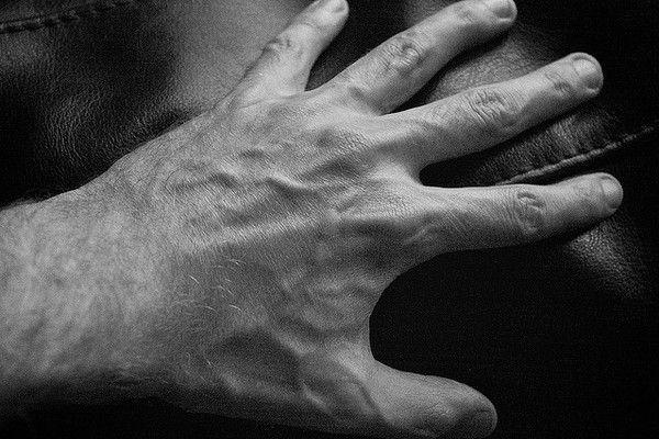 Cubital Tunnel Syndrome  Rothman Orthopaedic Institute