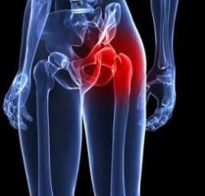 Reducing Post-Operative Pain from Hip Replacement