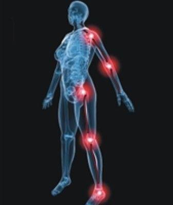 Check Your Symptoms: Arm or Leg Pain Without Weakness | Rothman ...