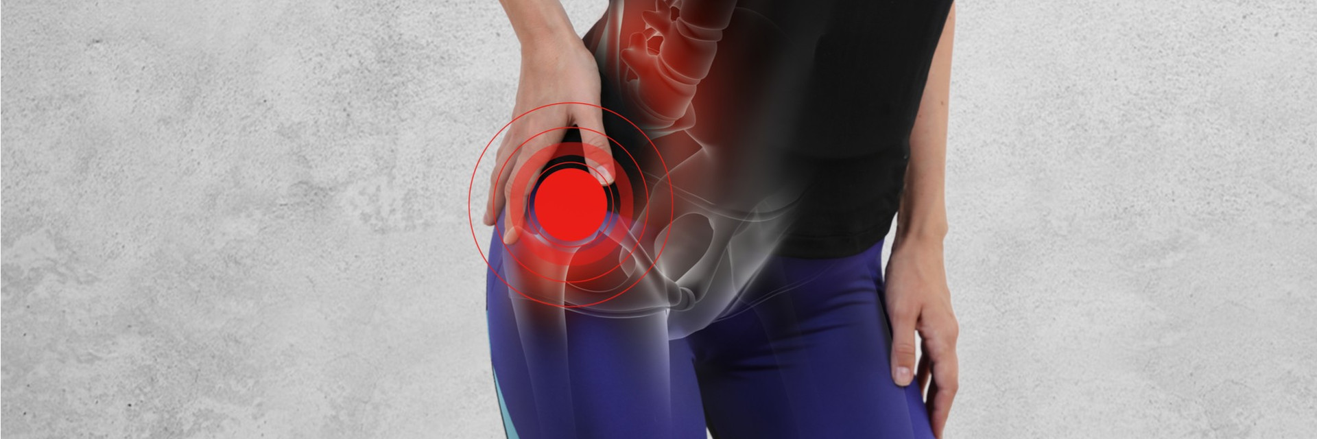 FAQs About Torn Hip Labrum Injuries