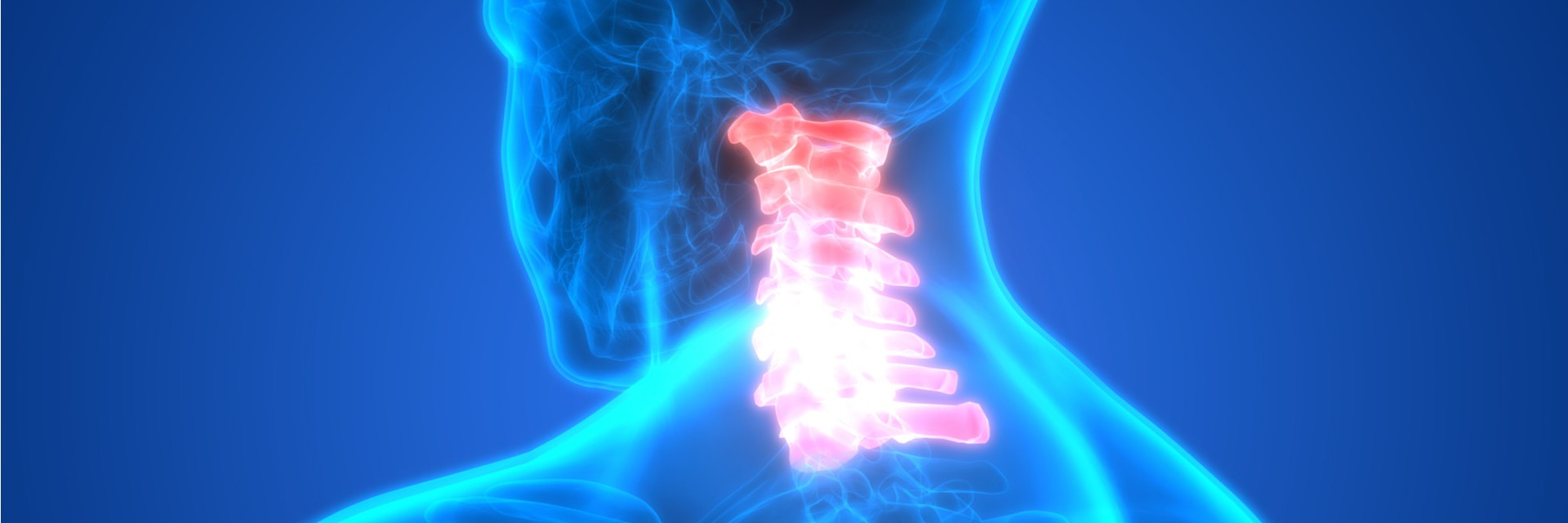 cervical-herniated-disc-treatment-in-nyc