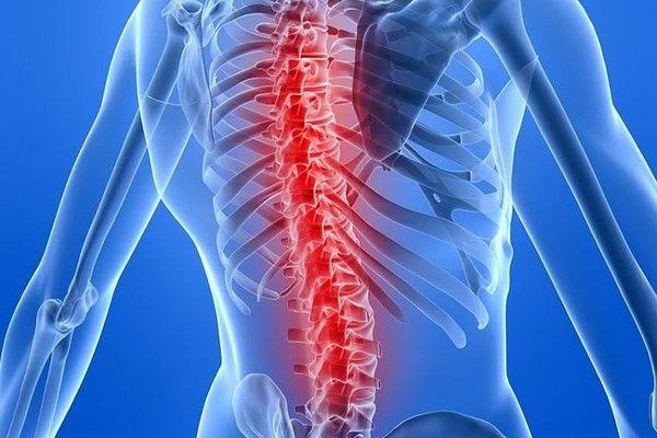 Bracing After a Spinal Injury: What to Expect