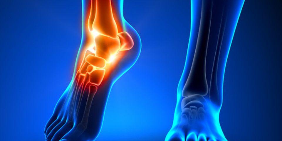 ankle sprain and achilles pain