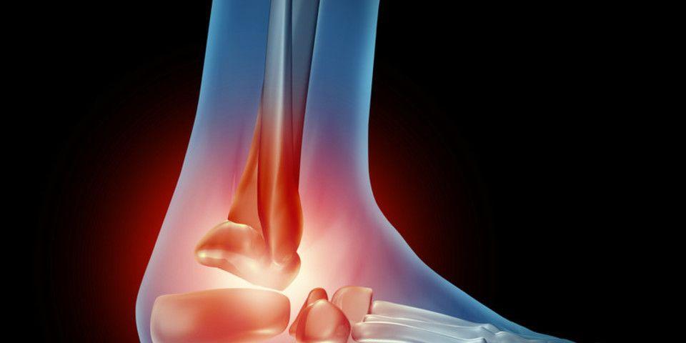 Ankle Sprain  Center Grove Foot & Ankle Care