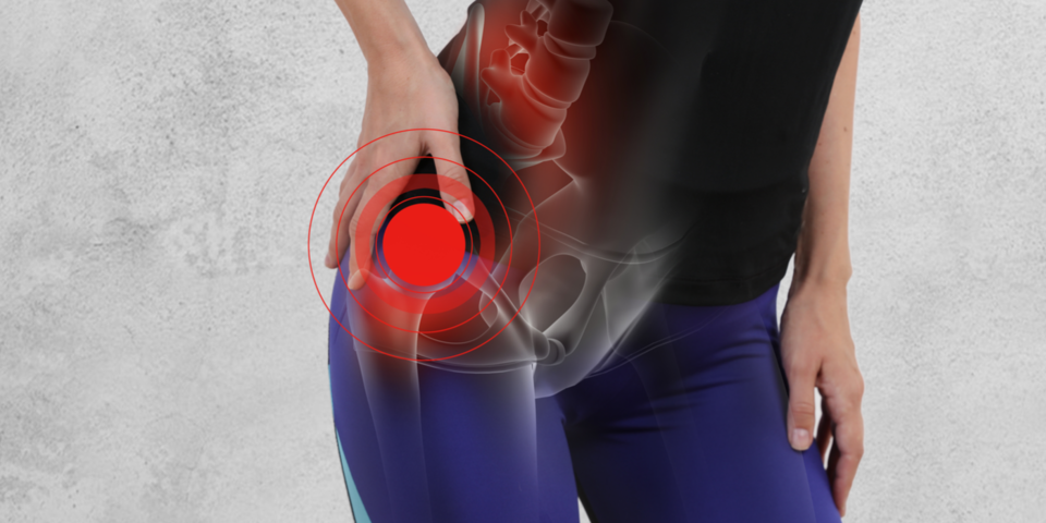 Faqs About Torn Hip Labrum Injuries Rothman Orthopaedic Institute 